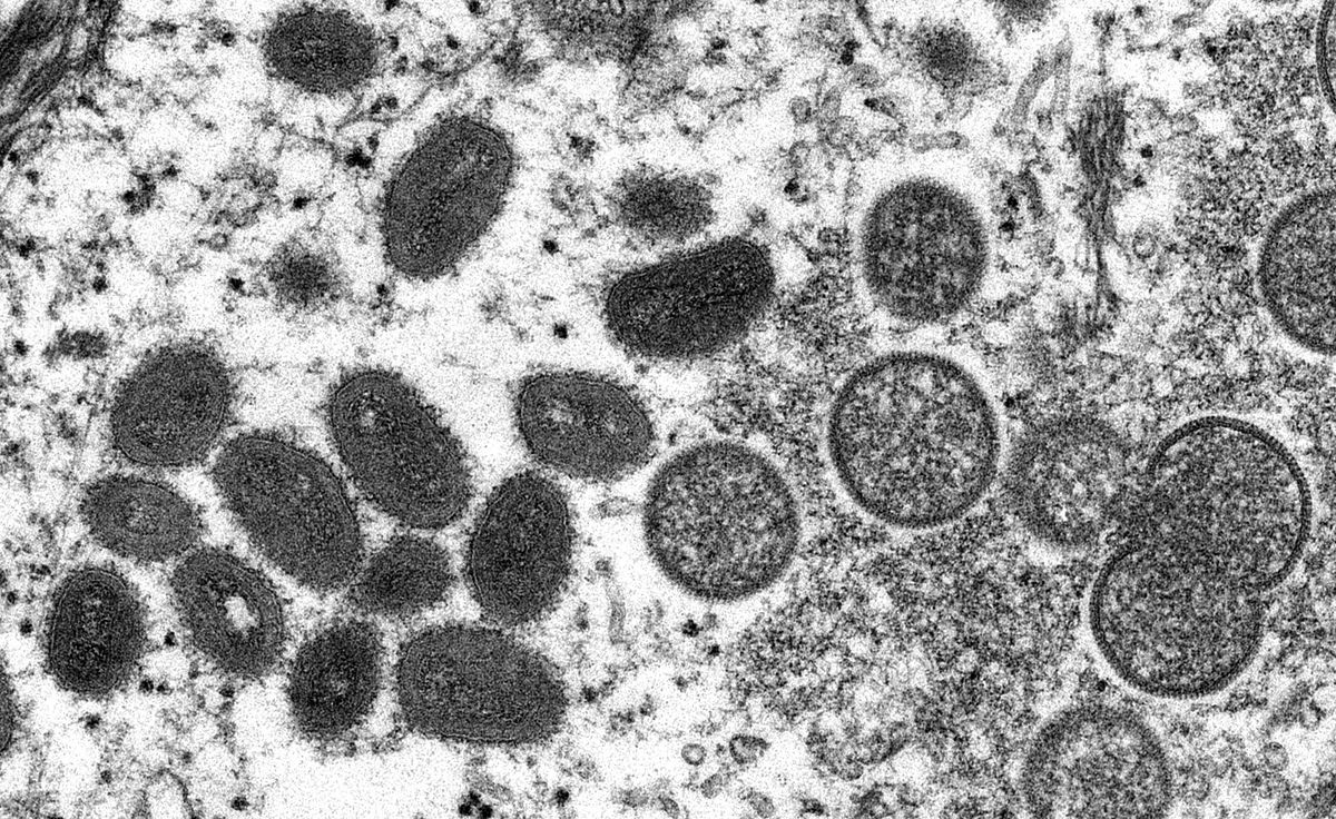 This undated electron microscopic (EM) handout image provided by the Centers for Disease Control and Prevention depicts a monkeypox virion, obtained from a clinical sample associated with the 2003 prairie dog outbreak. - It was a thin section image from a human skin sample. On the left were mature, oval-shaped virus particles, and on the right were the crescents, and spherical particles of immature virions. (Photo by Cynthia S. Goldsmith / Centers for Disease Control and Prevention / AFP) / RESTRICTED TO EDITORIAL USE - MANDATORY CREDIT "AFP PHOTO / Cynthia S. Goldsmith, Russell Regnery / Centers for Disease Control and Prevention "