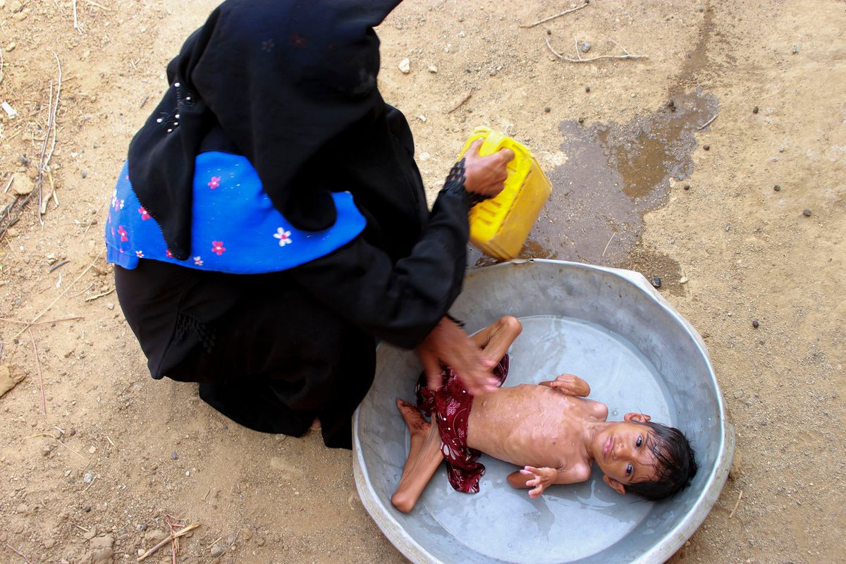 Salwa Ibrahim, a five-year-old girl suffering from acute malnutrition and weighing three kilograms, is bathed by her mother outside their impoverished house in Yemen's northern Hajjah province on June 23, 2020. - The country's health system has all but collapsed since war broke out between the government and Huthi rebels in 2014, and more than two thirds of the population of about 24 million need aid to survive, according to the United Nations. (Photo by ESSA AHMED / AFP)