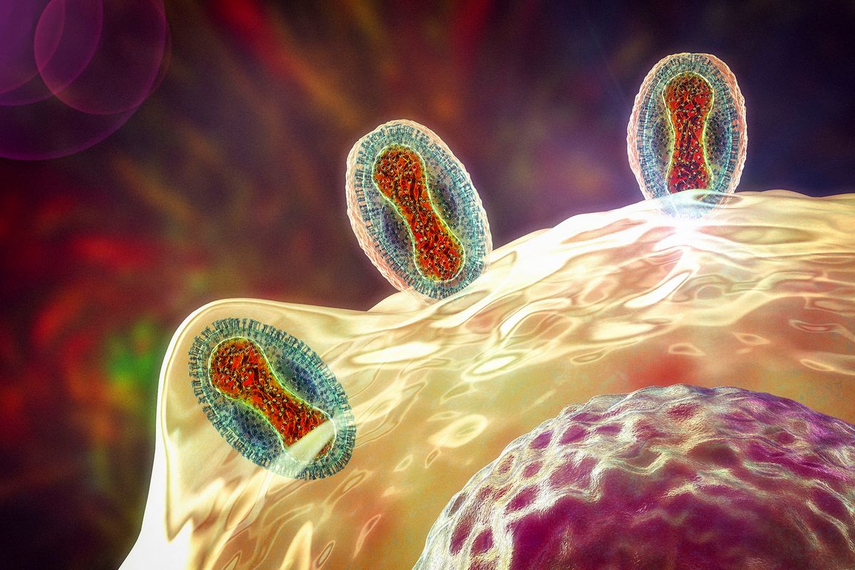 Monkeypox viruses infecting a human cell, illustration. Monkeypox virus particles are composed of a DNA (deoxyribonucleic acid) genome surrounded by a protein coat and lipid envelope. This virus, which is found near rainforests in Central and West Africa causes disease in humans and monkeys, although its natural hosts are rodents. It is capable of human to human transmission. In humans it causes fever, swollen glands and a rash of fluid-filled blisters. It is fatal in 10 per cent of cases. (Photo by KATERYNA KON/SCIENCE PHOTO LIBRA / KKO / Science Photo Library via AFP)