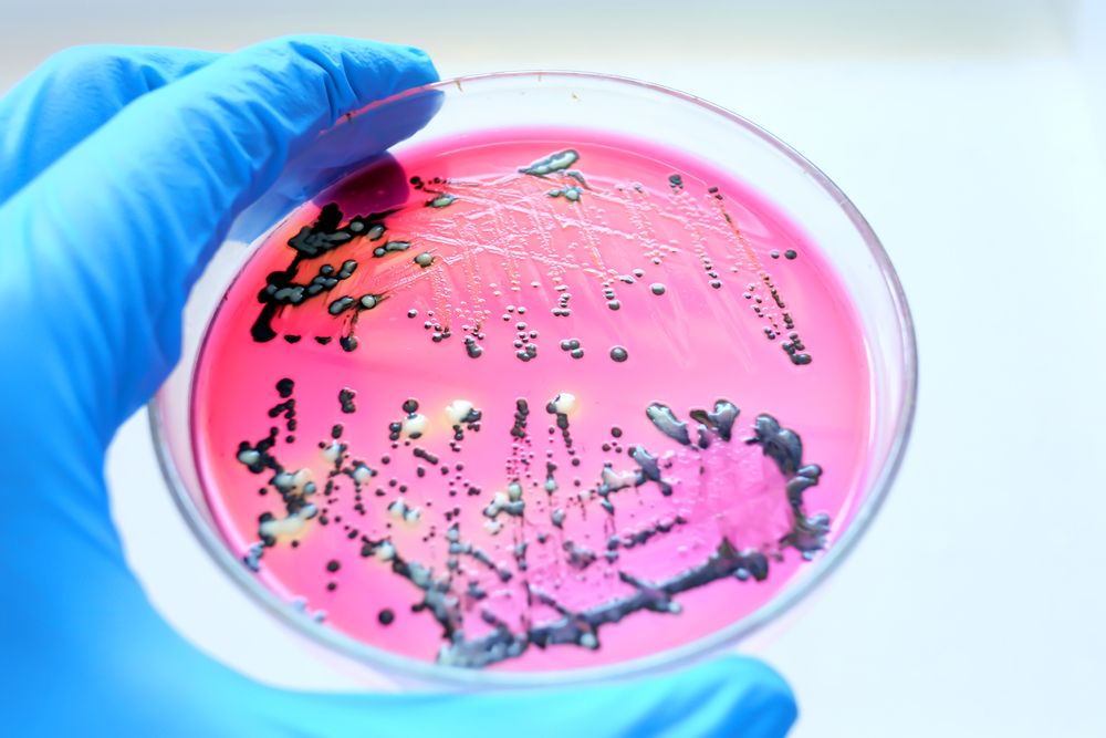 Close-up,Black,Colonies,Of,Salmonella,Bacteria,That,Produce,Hydrogen,Sulfide