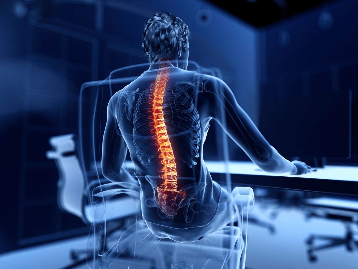Illustration of an office worker with a painful back. (Photo by SCIEPRO/SCIENCE PHOTO LIBRARY / SKU / Science Photo Library via AFP)