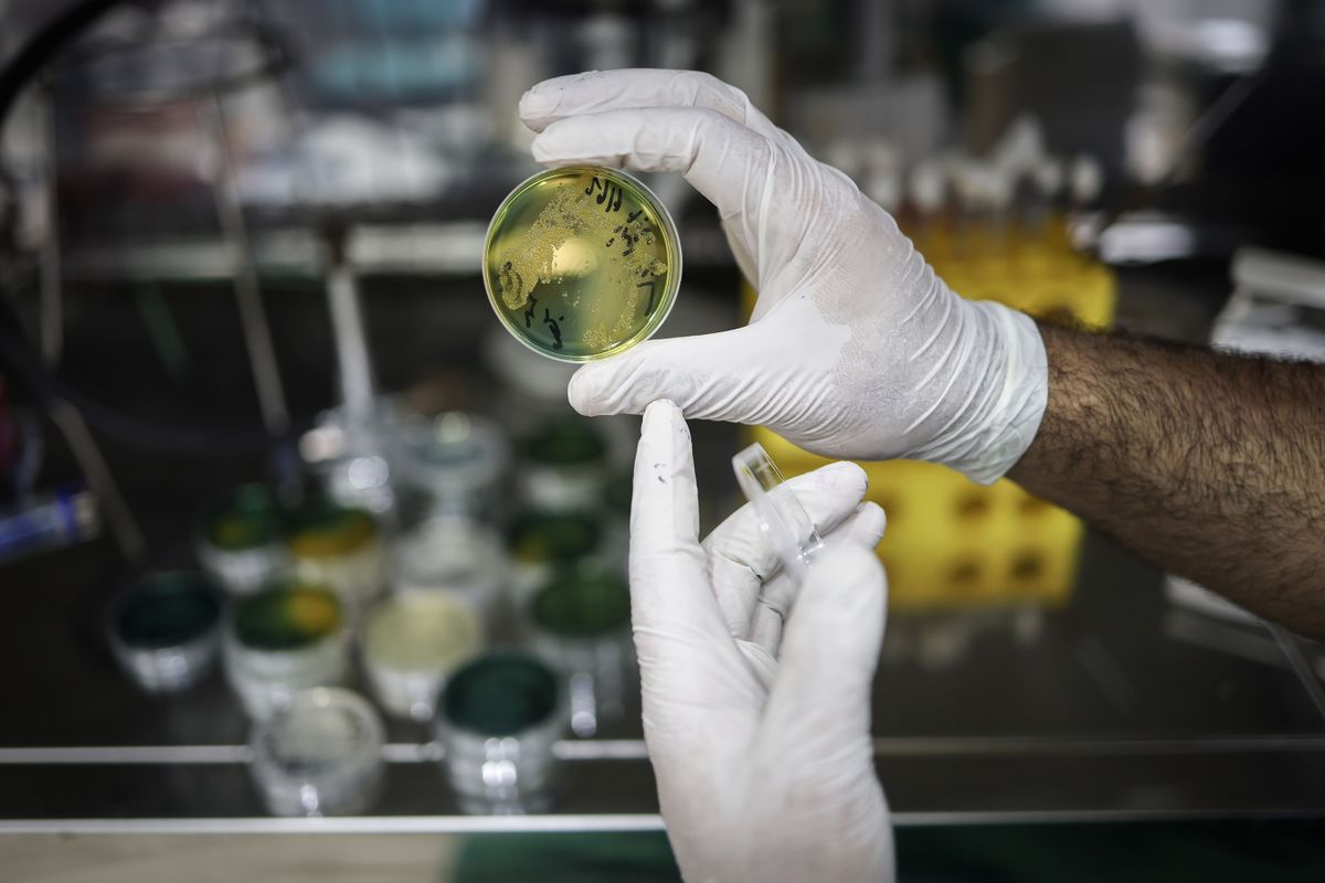 30 September 2022, Syria, Idlib: A lab technician works on samples of suspected Cholera in a medical laboratory of the Early Warning, Alert and Response Network (EWARN)network in Idlib. According to the latest statistics of EWARN, a total of 5,973 suspected Cholera cases have been reported between 25 August and 23 September 2022 in 9 Syrian governorates, most of which are camp residents. 