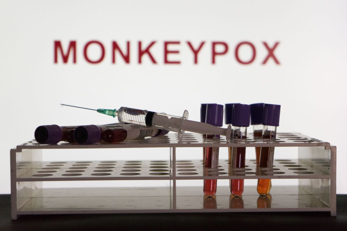 Monkeypox Virus Photo Illustrations