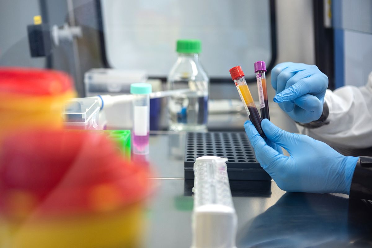 Pécs, 2023. február 7.Virológiai vizsgálati minták a PTE Szentágothai János Kutatóközpontjának laboratóriumában 2023. február 7-én. A koronavírus, továbbá a későbbiekben más kórokozók által kiváltott antitestes és sejtes immunválasz mérésére szolgáló eszközt és eljárást fejlesztettek ki a Pécsi Tudományegyetem (PTE) és a RoLink Biotechnology Kft. kutatói.MTI/Ruprech Judit Pécs, 2023. február 7.
Virológiai vizsgálati minták a PTE Szentágothai János Kutatóközpontjának laboratóriumában 2023. február 7-én. A koronavírus, továbbá a későbbiekben más kórokozók által kiváltott antitestes és sejtes immunválasz mérésére szolgáló eszközt és eljárást fejlesztettek ki a Pécsi Tudományegyetem (PTE) és a RoLink Biotechnology Kft. kutatói.
MTI/Ruprech Judit