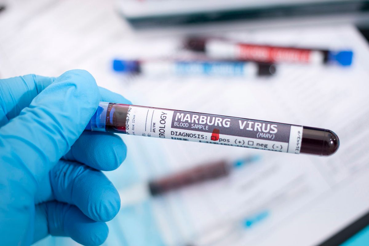 Blood samples with infected virus
Marburg