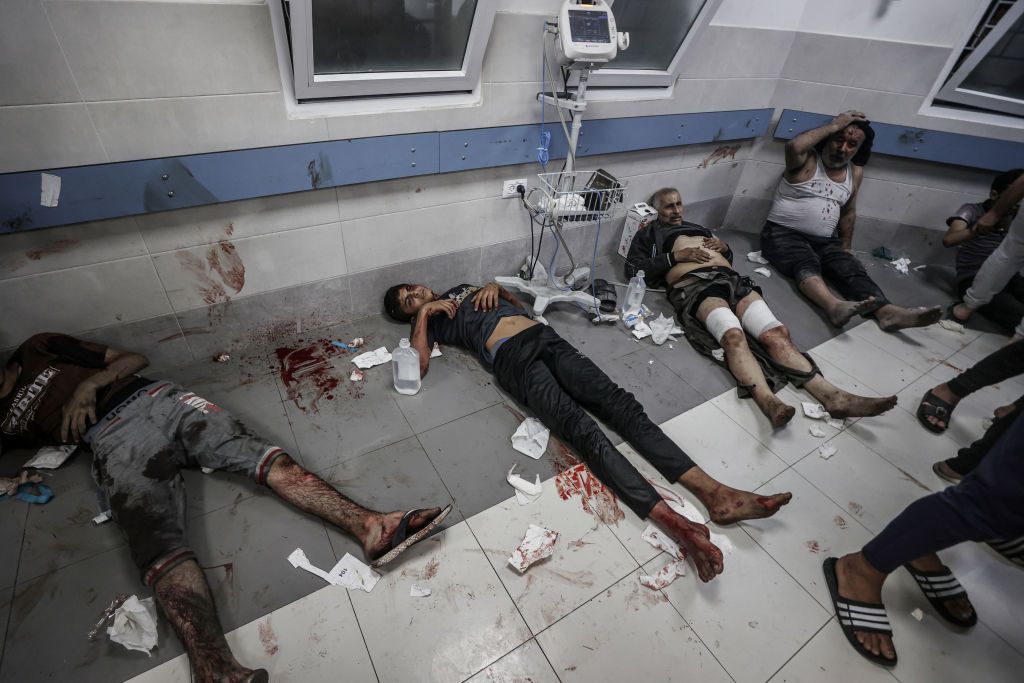 Hundreds killed in Israeli attack on Gaza Al-Ahli Baptist HospitalGAZA CITY, GAZA - OCTOBER 17: (EDITORS NOTE: Image depicts graphic content) Scores of injured people are being taken to Al-Shifa Hospital following Israeli airstrike on Al-Ahli Baptist Hospital in Gaza City, Gaza on October 17, 2023. Over 500 people were killed in an Israeli airstrike on Al-Ahli Baptist Hospital in Gaza on Tuesday, Health Ministry spokesman Ashraf al-Qudra told. (Photo by Ali Jadallah/Anadolu via Getty Images)