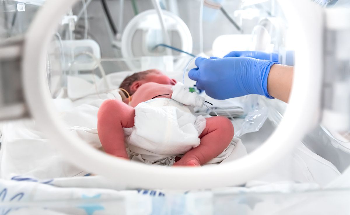 Photo,Of,A,Premature,Baby,In,Incubator.,Focus,Is,On