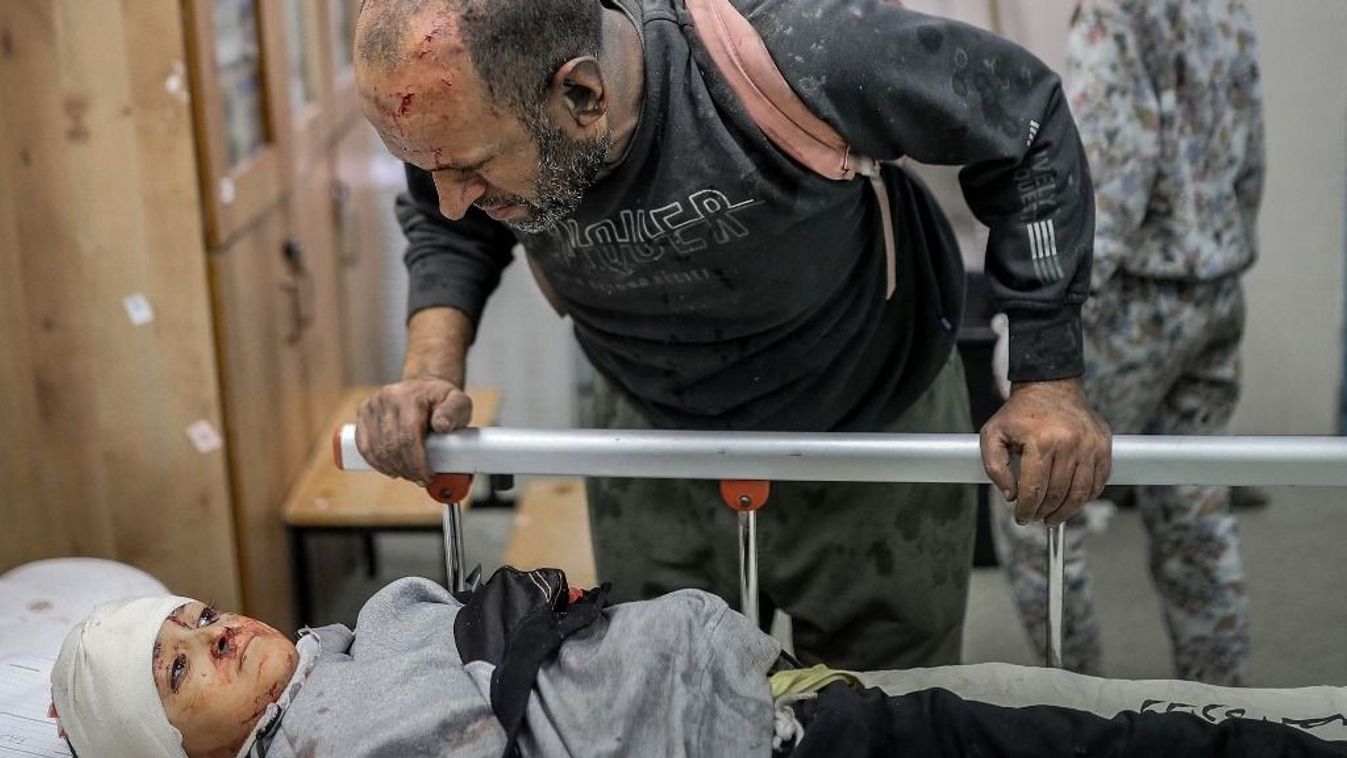 An injured Palestinian man looks at an injured child lying on a gurney at the hospital following the Israeli bombardment of Khan Yunis in the southern Gaza Strip on November 15, 2023, amid the ongoing battles between Israel and the Palestinian group Hamas. More than 10,000 people have been killed in relentless Israeli bombardment of the Gaza Strip, according to the Hamas-run health ministry, since the war erupted after Palestinian militants raided southern Israel on October 7 killing at least 1200 people, according to official Israeli figures. (Photo by Belal KHALED / AFP)