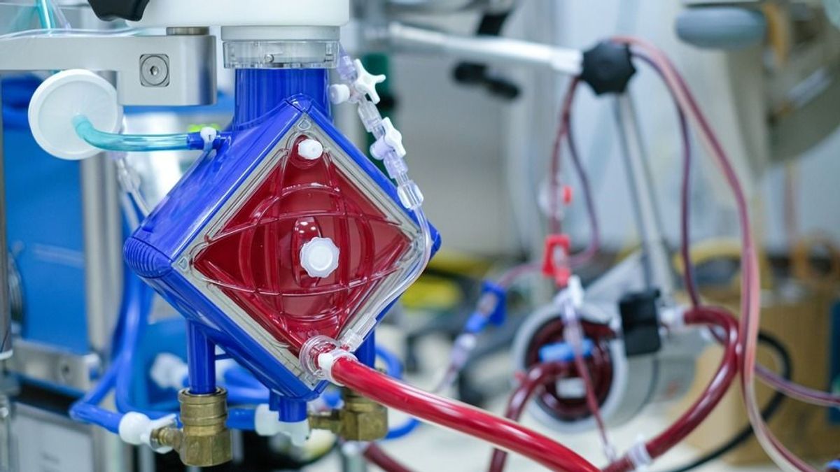 Magyarország száz darab lélegeztetőgépeket küldött Ukrajnának