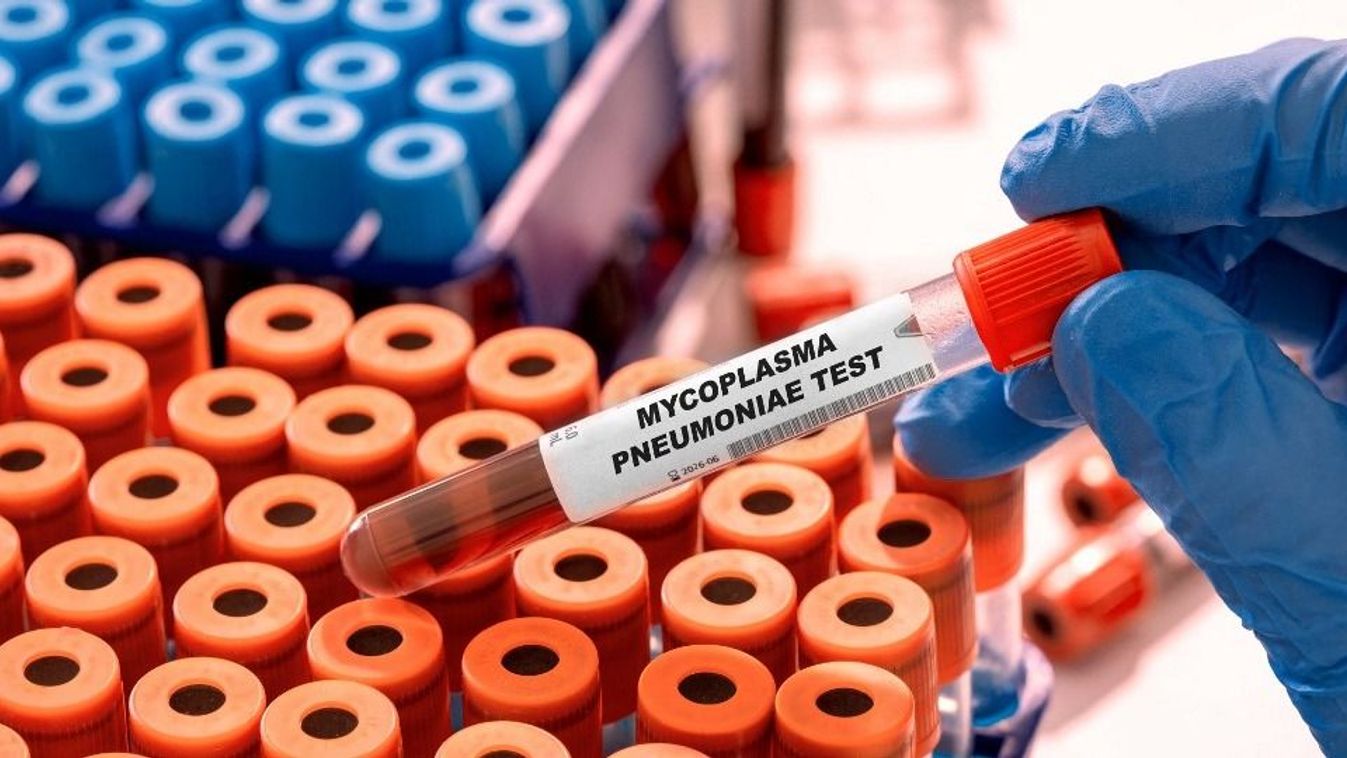Mycoplasma pneumoniae blood test, conceptual image