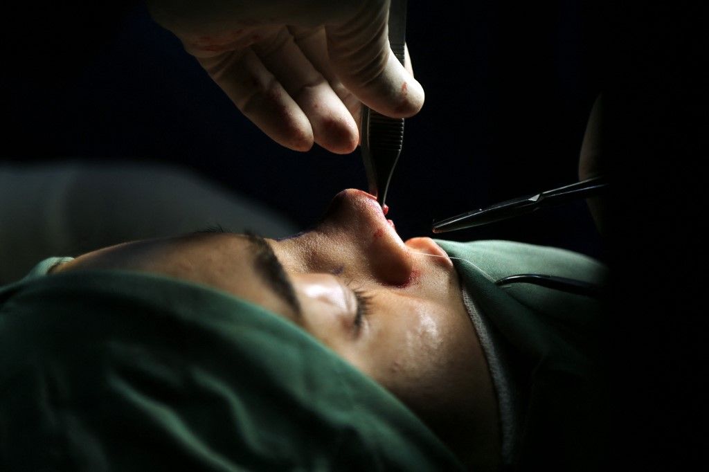 Increasing number of plastic surgeries in Iran