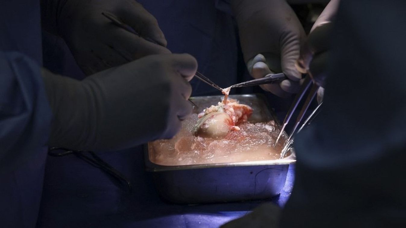 In this March 16, 2024, image courtesy of the Massachusetts General Hospital in Boston, Massachusetts, surgeons prepare the pig kidney for transplantation during the world’s first genetically modified pig kidney transplant into a living human. A team of surgeons have successfully transplanted a pig kidney into a living patient for the first time, the hospital said on March 21, 2024. The four-hour-long operation was carried out on March 16 on a 62-year-old man suffering from end-stage kidney disease, the hospital said. (Photo by Michelle ROSE / Massachusetts General Hospital / AFP) / RESTRICTED TO EDITORIAL USE - MANDATORY CREDIT "AFP PHOTO / Massachusetts General Hospital/Michelle ROSE" - NO MARKETING NO ADVERTISING CAMPAIGNS - DISTRIBUTED AS A SERVICE TO CLIENTS