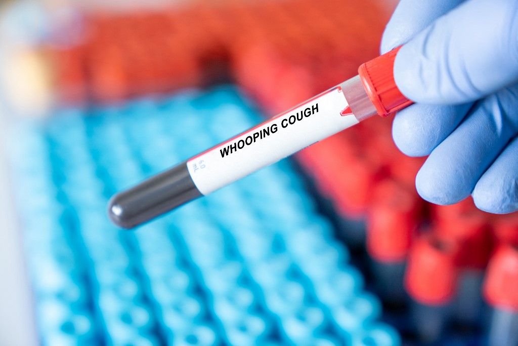 Whooping cough blood test. (Photo by WLADIMIR BULGAR/SCIENCE PHOTO LI / WBU / Science Photo Library via AFP) szamárköhögés