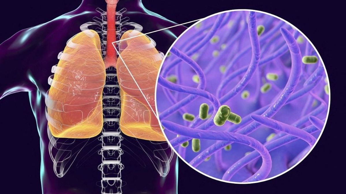 Szamárköhögés miatt halt meg két csecsemő Magyarországon – itthon még nincs járvány