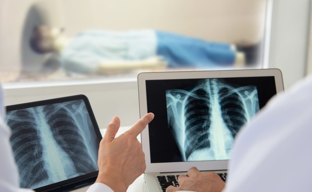 Doctor,Examining,At,Lungs,Radiograph,X-ray,Film,Of,Patient,In