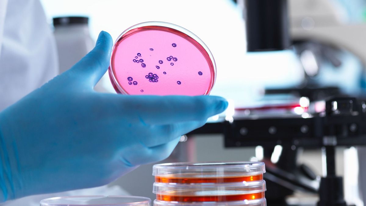 Microbiology, Scientist using an inverted light microscope to view culture growth in petri dishes during a experiment in a laboratory