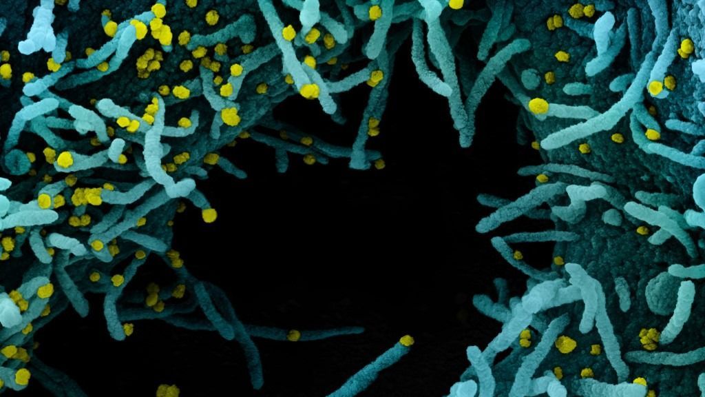 Novel coronavirus sars-cov-2 Új koronavírust azonosították Kínában