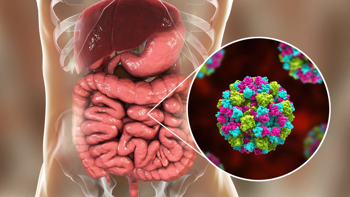 Norovirus infection, illustration norovírus