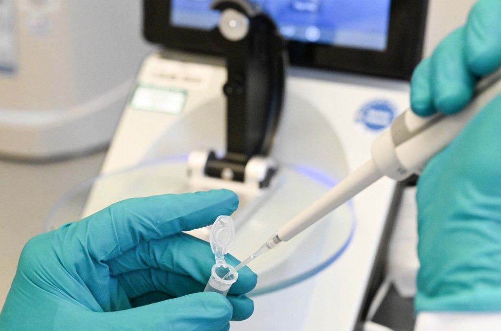 Biotech company Curevac A német titkosszolgálat szerint a pandémiát okozó koronavírus a vuhani laboratóriumból szivárgott ki.