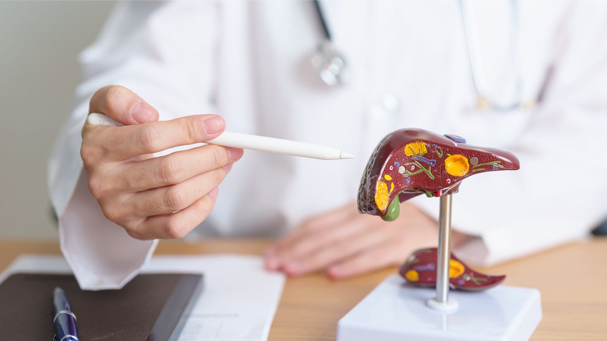 Doctor,With,Human,Liver,Anatomy,Model.,Liver,Cancer,And,Tumor, hepatitis a, orvos, máj, 