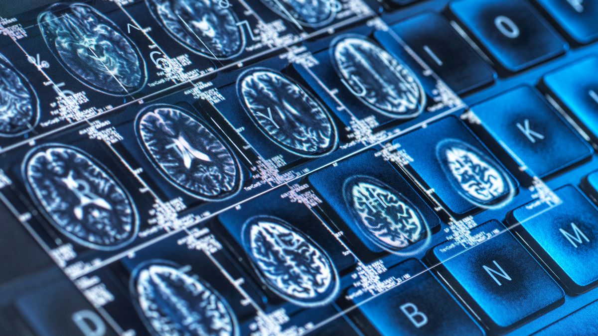Medical artificial intelligence , conceptual image Ambience Healthcare