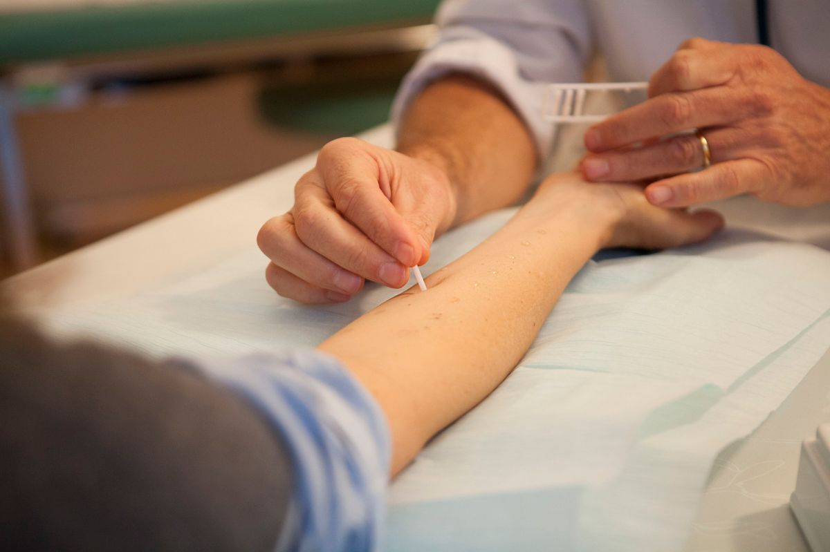 Allergy tests, allergia
