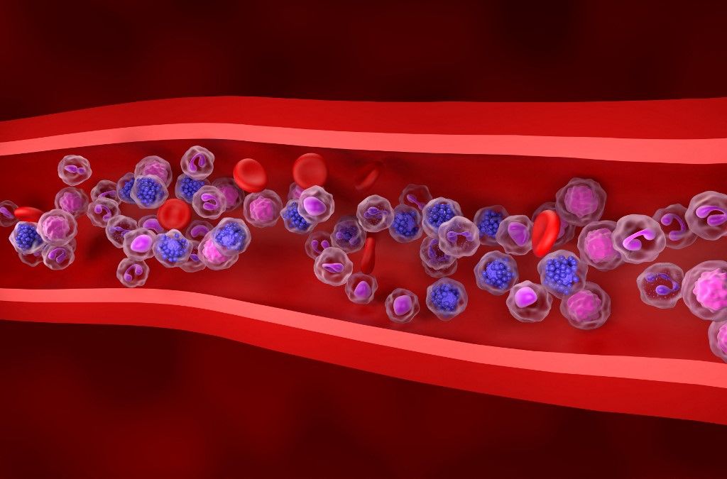 Diffuse large B-cell lymphoma, illustration Áttörés a rák gyógyításában: magyar kutatók jöttek rá – így növelhető jelentősen a túlélés esélye rák