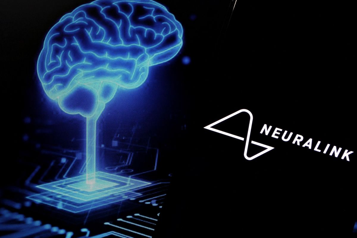 Újra beleköpnek Musk levesébe: most a Neuralink  is kihívót kaphat, nem is akármilyent