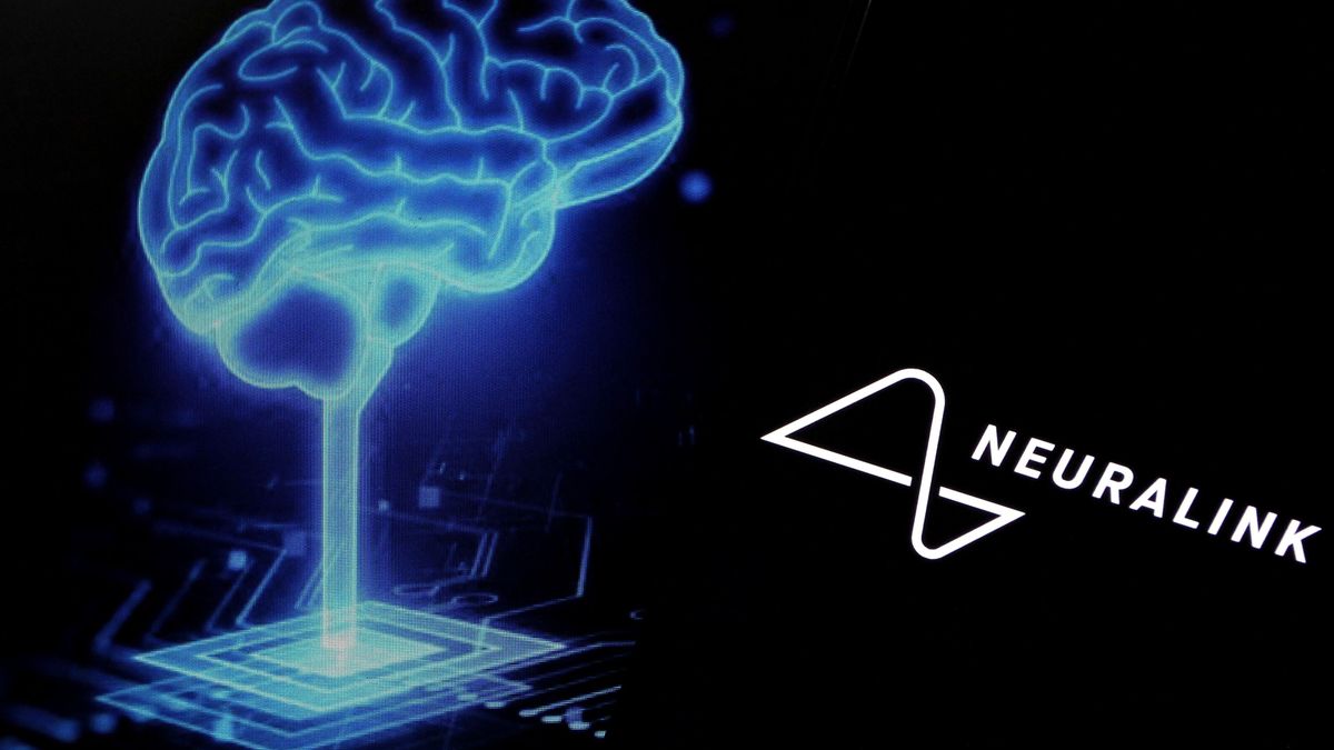 Újra beleköpnek Musk levesébe: most a Neuralink is kihívót kaphat, nem is akármilyent 